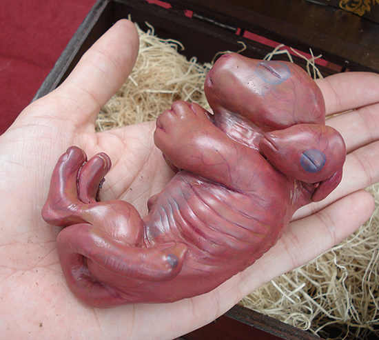 Chimera-fetus3